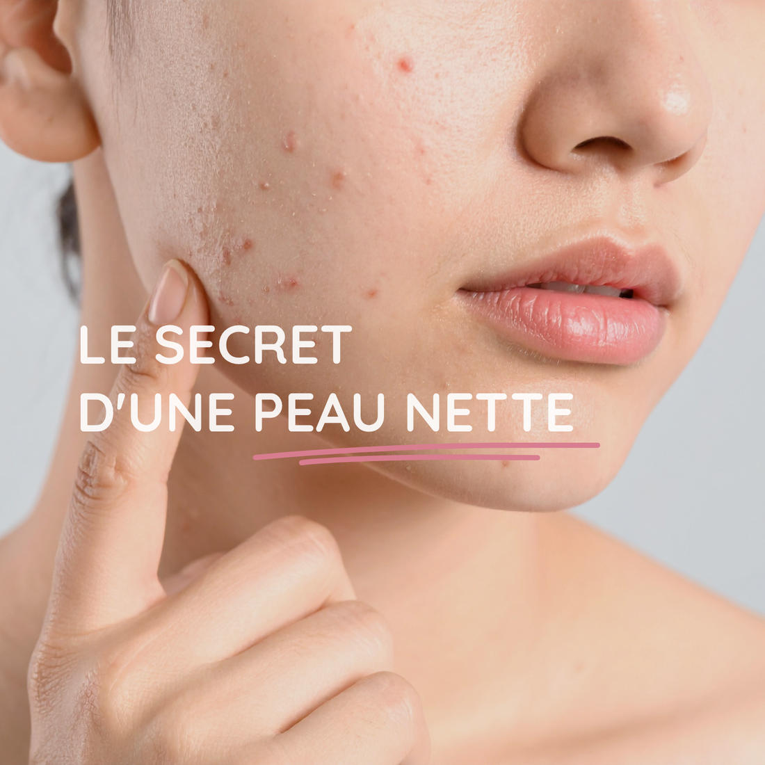 Le secret d'une peau nette.