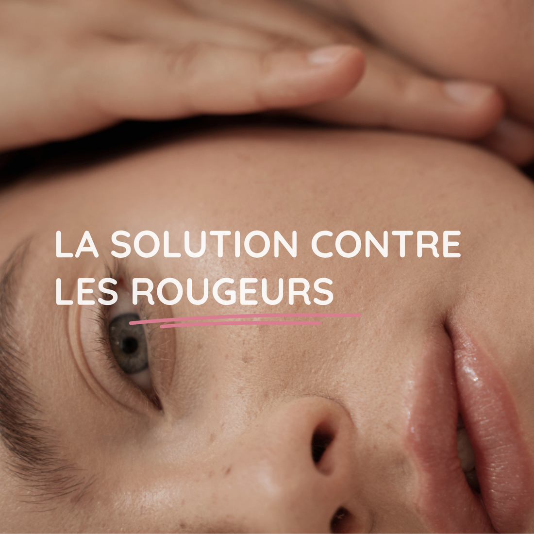 La solution méconnue contre les rougeurs.