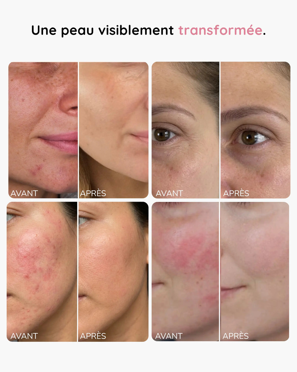 Bénéfices de la taie d'oreiller en soie de mûrier 22 momme Nesely : peau, cheveux et sommeil